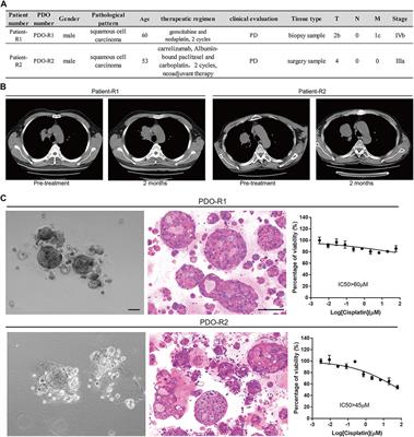 Halofuginone Sensitizes Lung Cancer Organoids to Cisplatin via Suppressing PI3K/AKT and MAPK Signaling Pathways